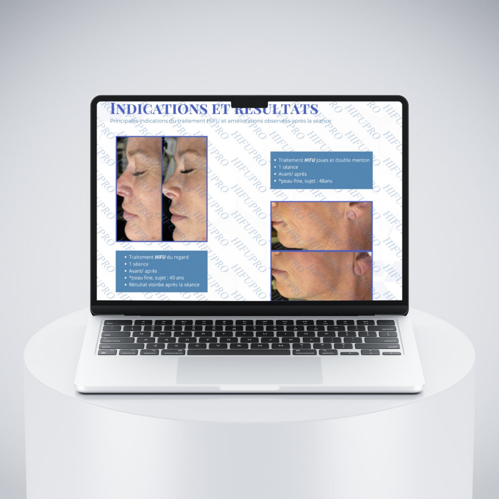 Protocoles HIFU visage et corps — Résultats formation Hifupro.fr certifiée CE
